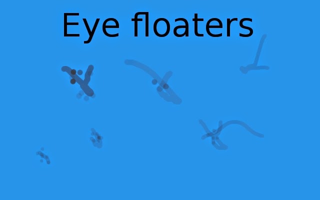 eye floaters pictures #11