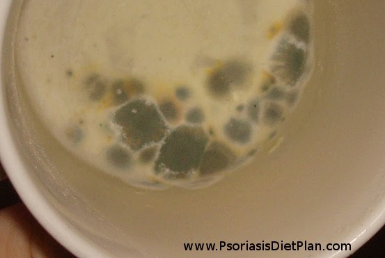 This is the macroscopic view of mold you saw in the photos above.