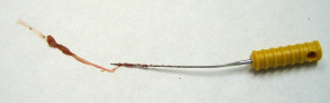 During the root canal therapy a dentist remove the pulp which contains the blood vessels and nerves supplying the tooth.