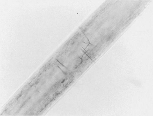 Branching of the fungus in the hair shaft.
