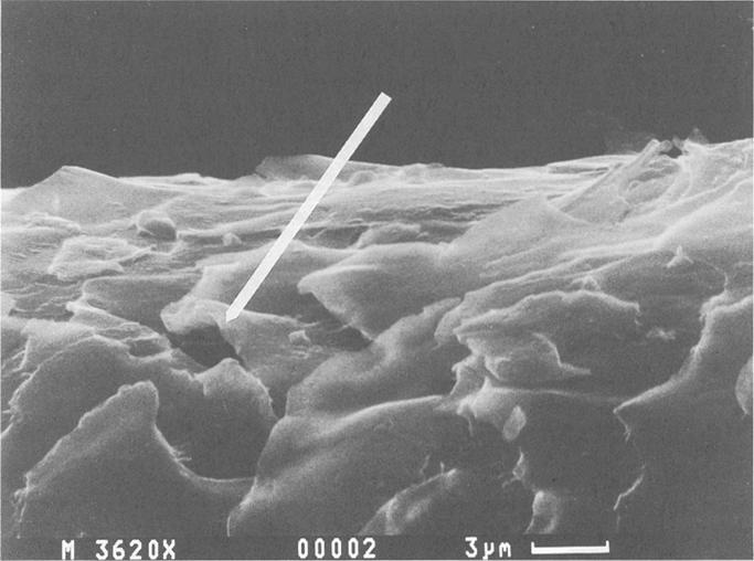 The entrance where the fungus enters into the hair shaft.