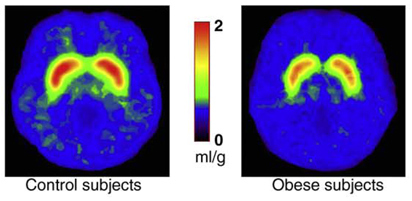 Dopaminergic activity in obese