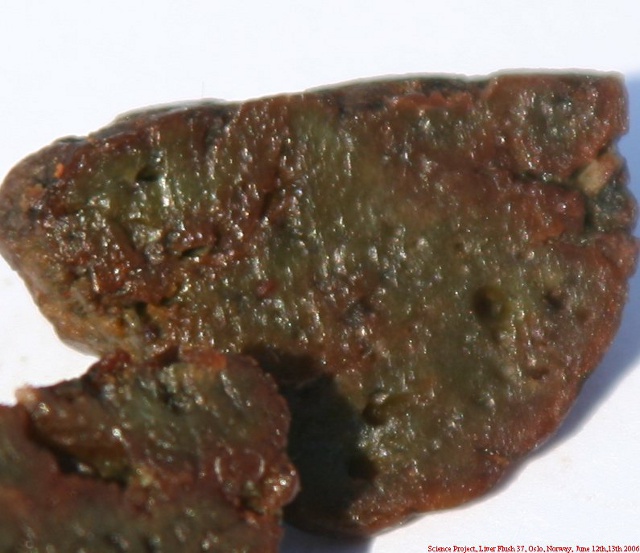 Dried fake gallstone - liver flush vs. psoriasis