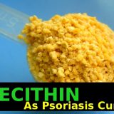 Lecithin cures psoriasis