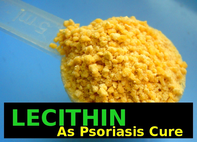 Lecithin cures psoriasis