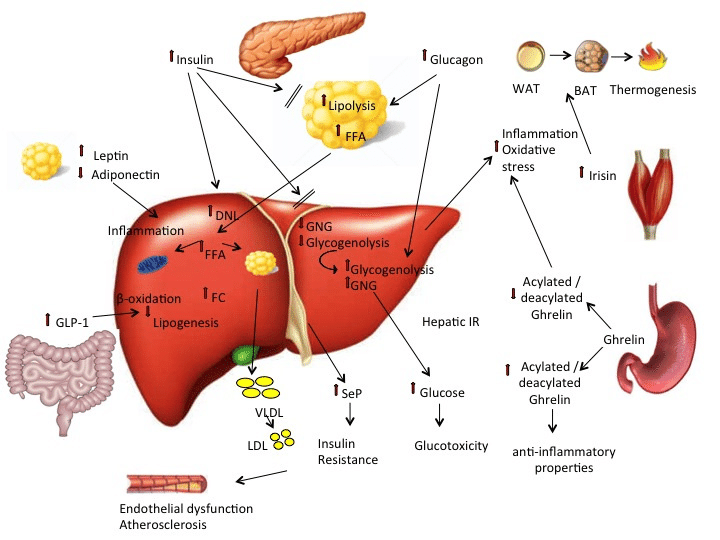 Fatty liver in 50% of psoriatics